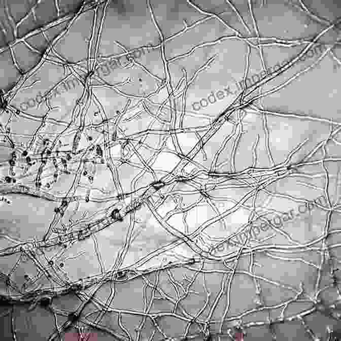 A Microscopic View Of Mushroom Mycelium, Revealing The Intricate Network Of Hyphae That Play A Crucial Role In Nutrient Absorption And Growth. Mushrooms: How To Grow Them A Practical Treatise On Mushroom Culture For Profit And Pleasure