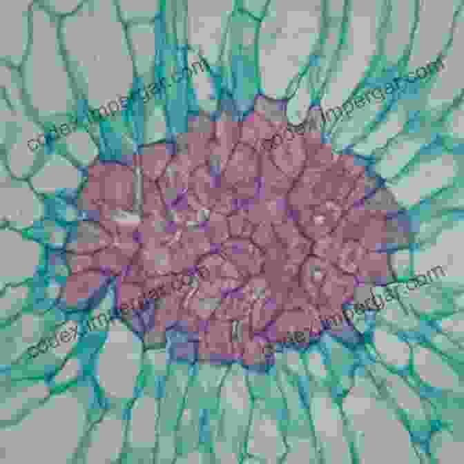 Microscopic Image Of Sclerenchyma Cells The Plant Stem: A Microscopic Aspect