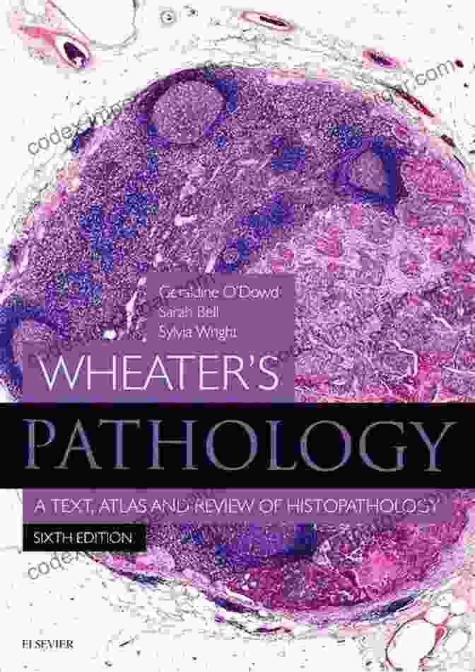 Wheater's Pathology Inkling Enhanced Book Cover Wheater S Pathology Inkling Enhanced E Book: With STUDENT CONSULT Online Access (Wheater S Histology And Pathology)