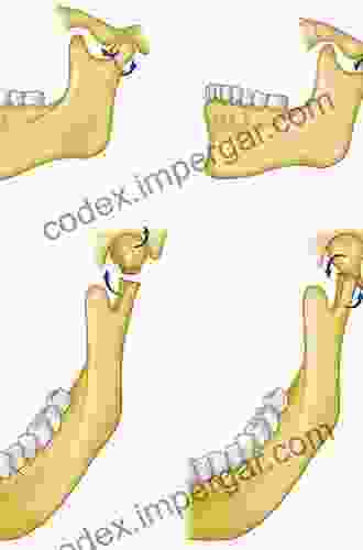 Advances In The Management Of Mandibular Condylar Fractures An Issue Of Atlas Of The Oral Maxillofacial Surgery (The Clinics: Surgery 25)