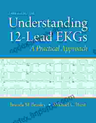 Understanding 12 Lead EKGs (2 Downloads) Brenda M Beasley